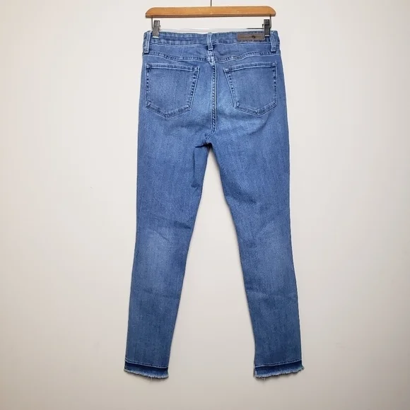 TREASURE & BOND Midrise Skinny Ankle Ripped Jeans - Picture 7 of 10